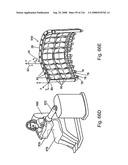 Radioimaging diagram and image