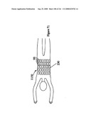 Radioimaging diagram and image