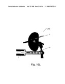 Radioimaging diagram and image