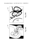 Radioimaging diagram and image