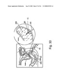 Radioimaging diagram and image