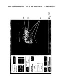 Radioimaging diagram and image