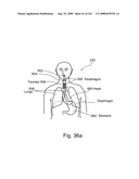 Radioimaging diagram and image