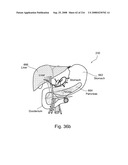 Radioimaging diagram and image