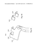 Radioimaging diagram and image