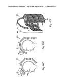 Radioimaging diagram and image