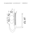 NOVEL POSITRON EMISSION DETECTORS AND CONFIGURATIONS diagram and image