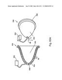 Radioimaging diagram and image