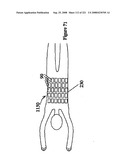 Radioimaging diagram and image