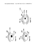 Radioimaging diagram and image