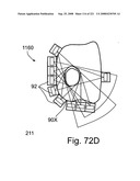 Radioimaging diagram and image