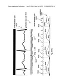 Radioimaging diagram and image