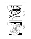 Radioimaging diagram and image