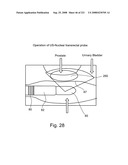 Radioimaging diagram and image