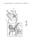 Radioimaging diagram and image