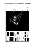 Radioimaging diagram and image