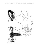 Radioimaging diagram and image