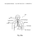 Radioimaging diagram and image