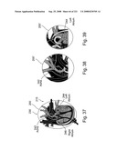 Radioimaging diagram and image