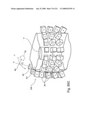 Radioimaging diagram and image