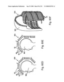 Radioimaging diagram and image