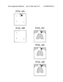 RADIOGRAPHIC IMAGING METHOD AND RADIOGRAPHIC IMAGING SYSTEM diagram and image