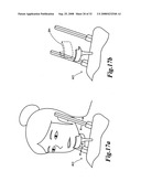 Display method of X-ray CT image of maxillofacial area, X-ray CT apparatus and X-ray image display apparatus diagram and image