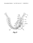 Display method of X-ray CT image of maxillofacial area, X-ray CT apparatus and X-ray image display apparatus diagram and image