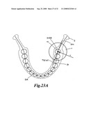 Display method of X-ray CT image of maxillofacial area, X-ray CT apparatus and X-ray image display apparatus diagram and image