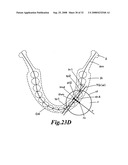 Display method of X-ray CT image of maxillofacial area, X-ray CT apparatus and X-ray image display apparatus diagram and image