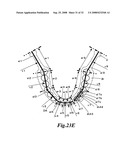 Display method of X-ray CT image of maxillofacial area, X-ray CT apparatus and X-ray image display apparatus diagram and image