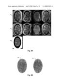 BIOMETRICS BASED ON LOCALLY CONSISTENT FEATURES diagram and image