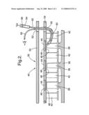 Method of repairing a damaged abradable coating diagram and image