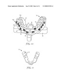 INDIRECT BONDING TRAYS FOR ORTHODONTIC TREATMENT AND METHODS FOR MAKING THE SAME diagram and image