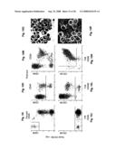 Diagnosis, prognosis and identification of potential therapeutic targets of multiple myeloma based on gene expression profiling diagram and image