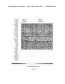 Diagnosis, prognosis and identification of potential therapeutic targets of multiple myeloma based on gene expression profiling diagram and image