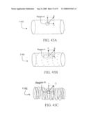 SYSTEMS AND METHODS OF PROMOTING ENDOTHELIALIZATION OF A HYBRID CAROTID BYPASS VASCULAR GRAFT IN A MAMMAL diagram and image