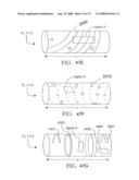 SYSTEMS AND METHODS OF PROMOTING ENDOTHELIALIZATION OF A HYBRID CAROTID BYPASS VASCULAR GRAFT IN A MAMMAL diagram and image