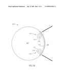 Mri Probe for Prostate Imaging diagram and image