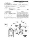 Passive Wireless Gastroesophageal Sensor diagram and image