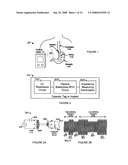 Passive Wireless Gastroesophageal Sensor diagram and image