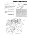 Anti-unscrewing and multi-angular fastening apparatuses and methods for surgical bone screw/plate systems diagram and image