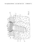 Anti-unscrewing and multi-angular fastening apparatuses and methods for surgical bone screw/plate systems diagram and image