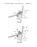 DEVICES AND METHODS FOR HEART VALVE REPAIR diagram and image