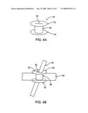 DEVICES AND METHODS FOR HEART VALVE REPAIR diagram and image