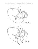 DEVICES AND METHODS FOR HEART VALVE REPAIR diagram and image