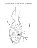 DEVICES AND METHODS FOR HEART VALVE REPAIR diagram and image