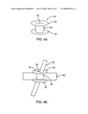 DEVICES AND METHODS FOR HEART VALVE REPAIR diagram and image