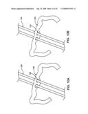 DEVICES AND METHODS FOR HEART VALVE REPAIR diagram and image