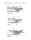 DEVICES AND METHODS FOR HEART VALVE REPAIR diagram and image